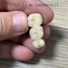 法国假牙生产厂家, 法国假牙加工厂