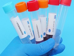 为什么推荐选择美迪科灭活型 非灭活型一次性使用病毒采样管？